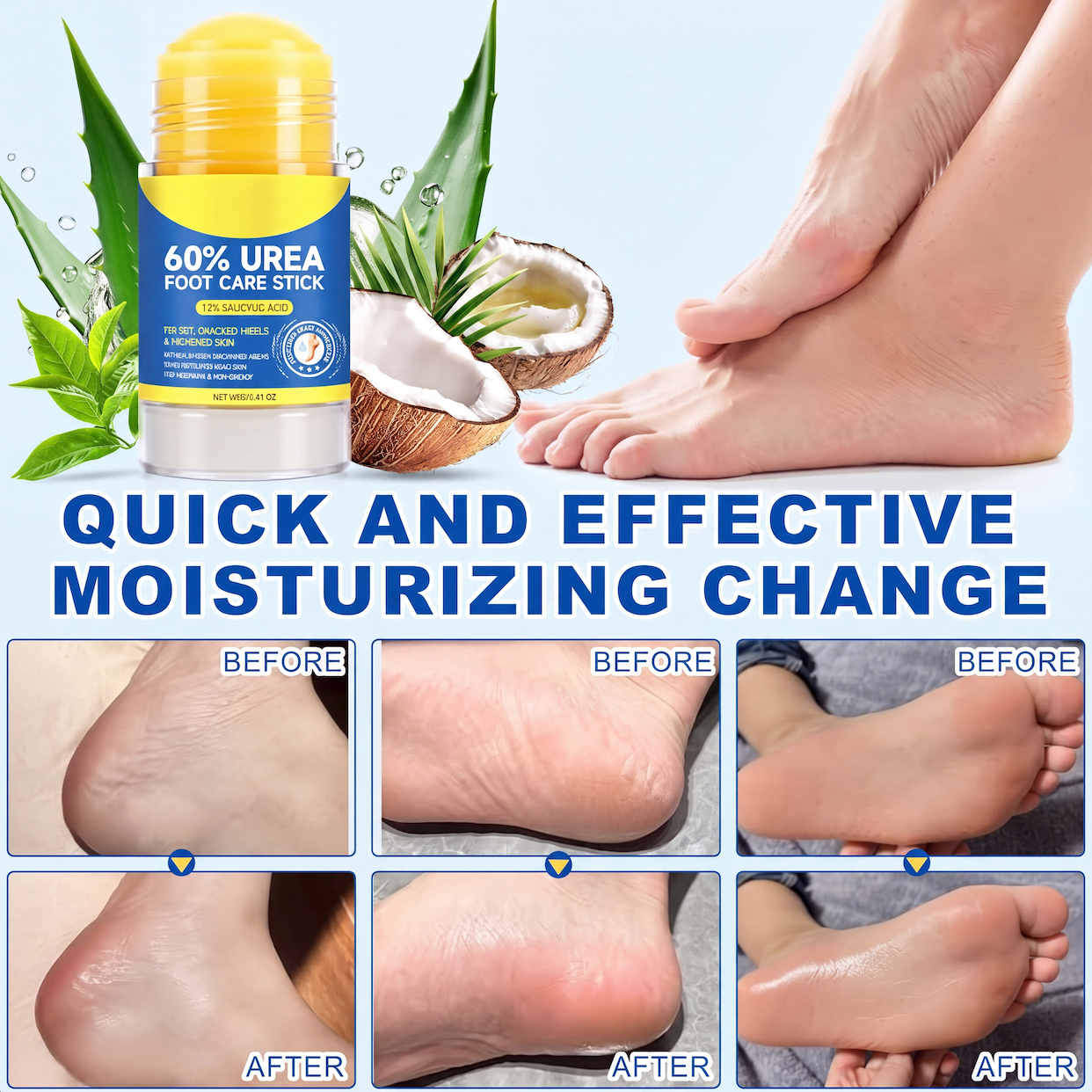 Urea & Salicylic Acid Foot Care Stick