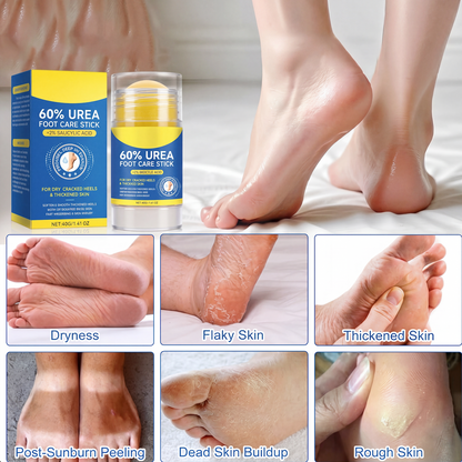 Urea & Salicylic Acid Foot Care Stick
