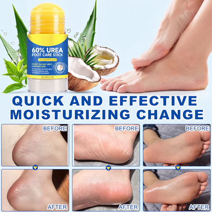 Urea & Salicylic Acid Foot Care Stick